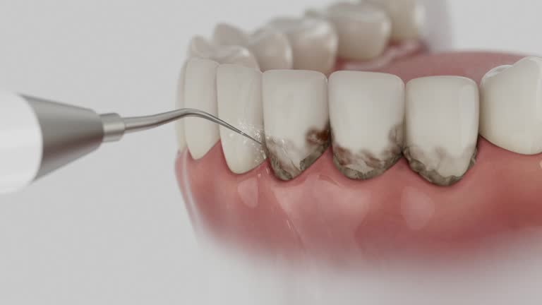 Reliable Tooth Extraction contractor in Five Points, NC by Smile Center Dentistry